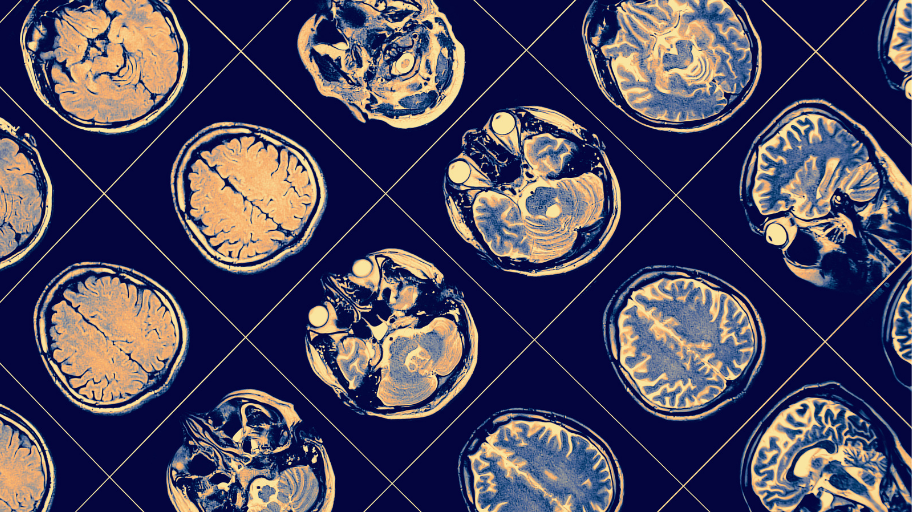 Inside Images, Outside Impact: Scans Explained